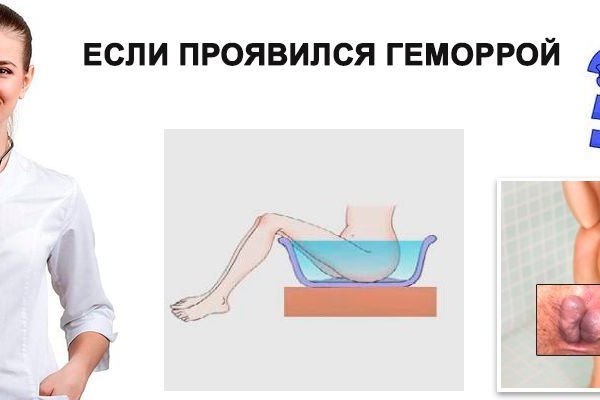 Что такое кракен маркетплейс